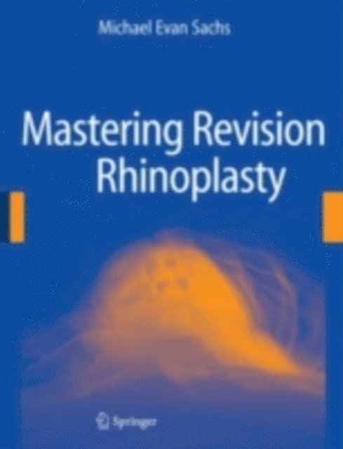 Michael Evan Sachs - Mastering Revision Rhinoplasty, E-bok