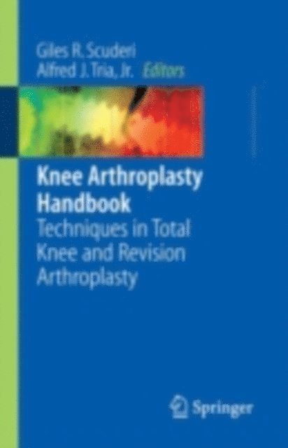Alfred J. Tria, Giles R. Scuderi - Knee Arthroplasty Handbook, E-bok