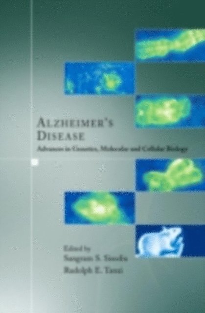 Rudolph E. Tanzi, Sangram S. Sisodia - Alzheimer's Disease, E-bok