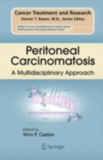 wim ceelen - Peritoneal Carcinomatosis: A Multidisciplinary Approach, E-bok