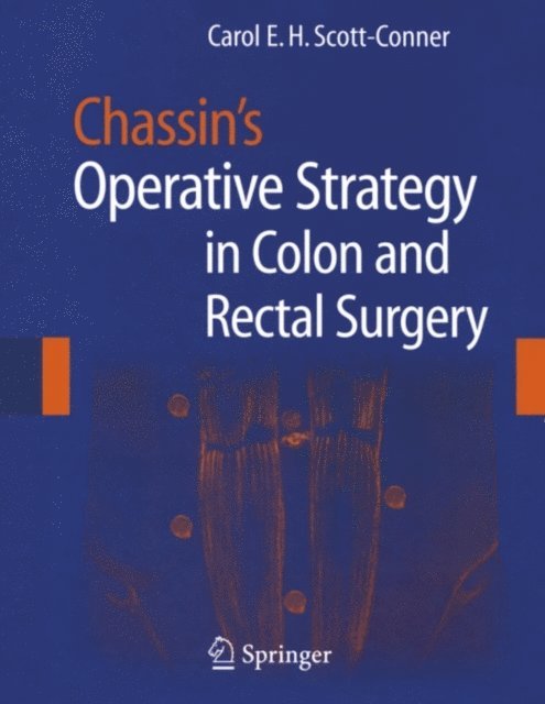 Carol E.H. Scott-Conner - Chassin's Operative Strategy in Colon and Rectal Surgery, E-bok