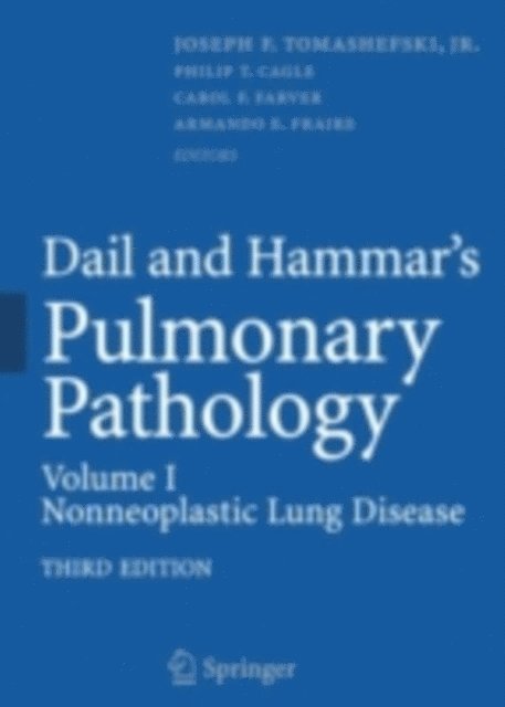 Joseph F. Tomashefski - Dail and Hammar's Pulmonary Pathology, E-bok