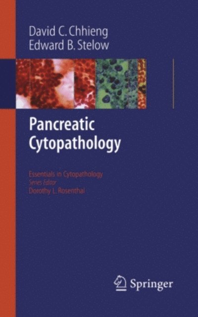 Edward B. Stelow, David C. Chhieng - Pancreatic Cytopathology, E-bok