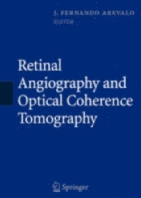 J. Fernando Arevalo - Retinal Angiography and Optical Coherence Tomography, E-bok