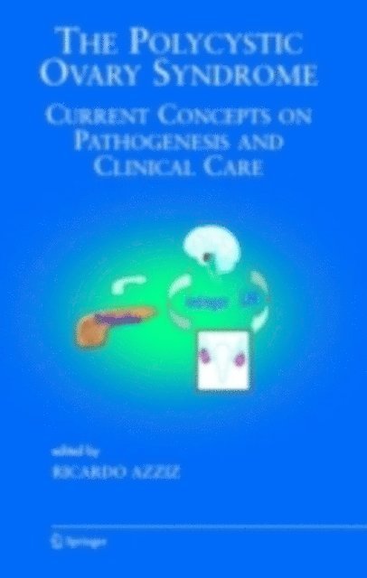 Ricardo Azziz - Polycystic Ovary Syndrome, E-bok