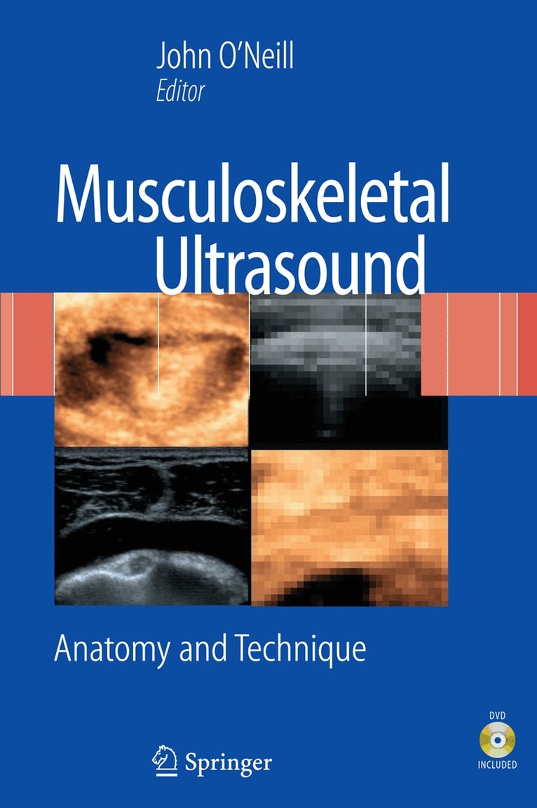 John M. D. O'Neill - Musculoskeletal Ultrasound. Tillgänglighet: Lägg i varukorg