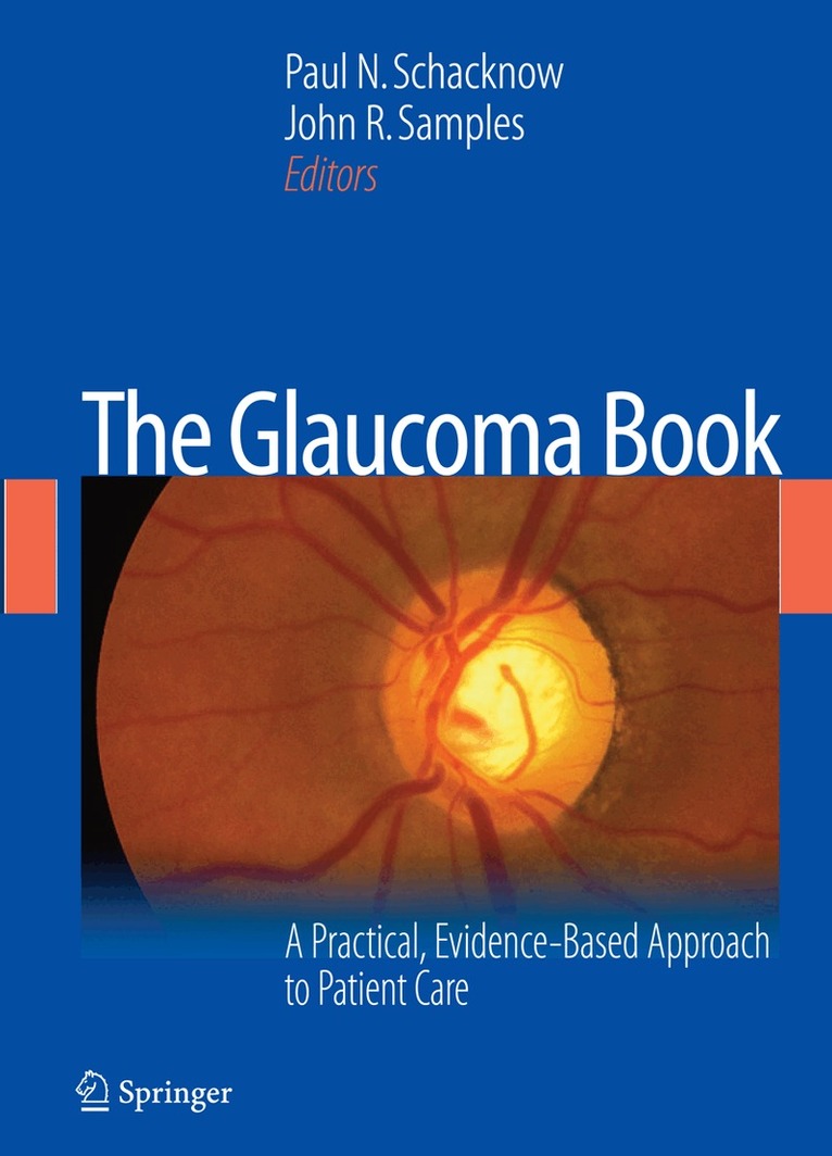 Glaucoma Book