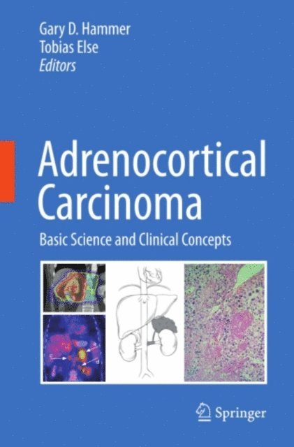 Tobias Else, Gary D. Hammer - Adrenocortical Carcinoma, E-bok