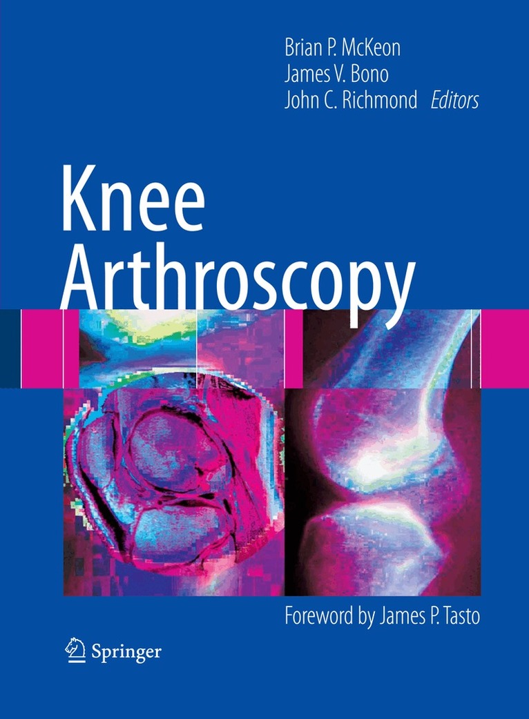 Brian P. McKeon, James V. Bono, John C. Richmond - Knee Arthroscopy, Inbunden