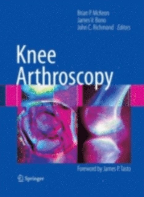 John C. Richmond, James V. Bono, Brian P. McKeon - Knee Arthroscopy, E-bok. Tillgänglighet: Lägg i varukorg
