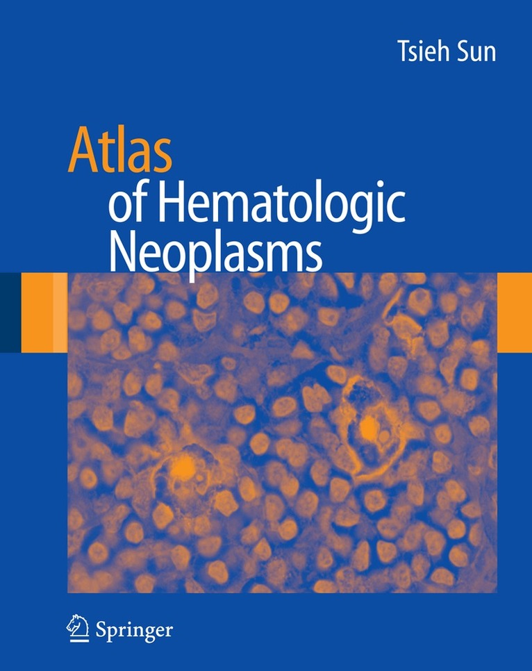 Tsieh Sun - Atlas of Hematologic Neoplasms, Inbunden. Tillgänglighet: Lägg i varukorg