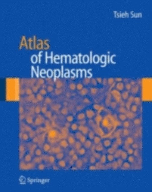 Tsieh Sun - Atlas of Hematologic Neoplasms, E-bok. Tillgänglighet: Lägg i varukorg
