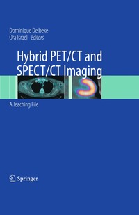 Hybrid PET/CT and SPECT/CT Imaging