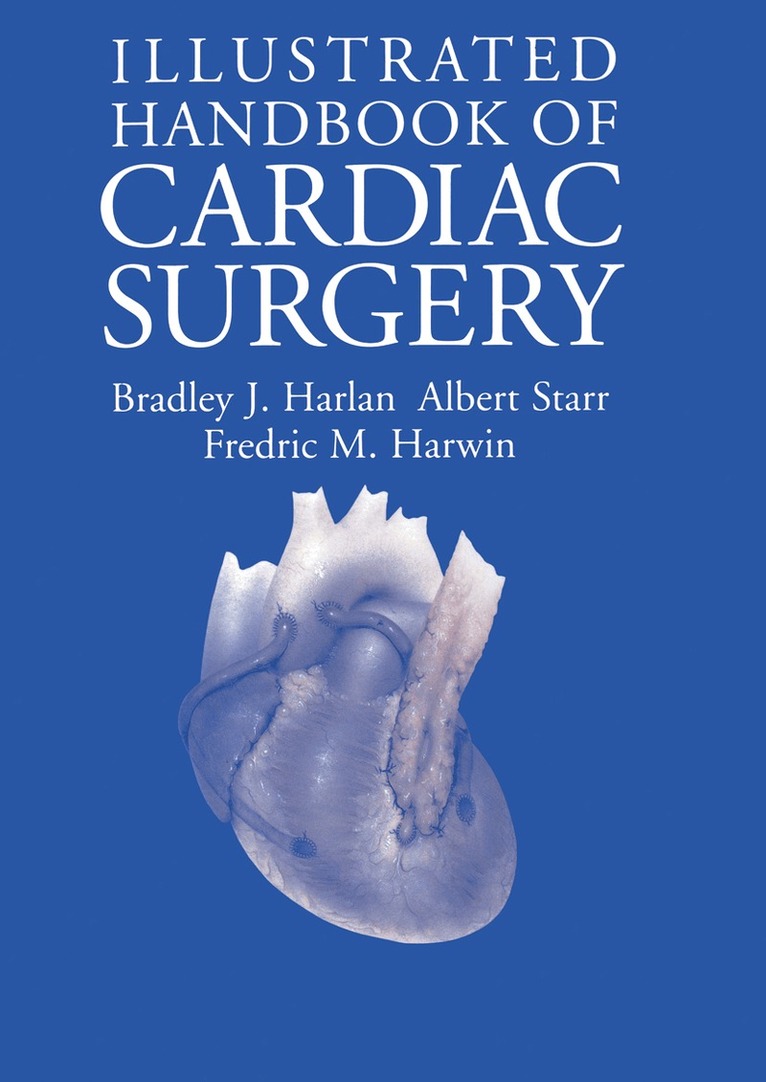 Bradley J. Harlan, Albert Starr, Fredric M. Harwin - Illustrated Handbook of Cardiac Surgery, Häftad