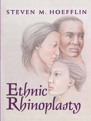 Steven M. Hoefflin - Ethnic Rhinoplasty, Inbunden. Tillgänglighet: Lägg i varukorg