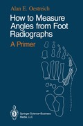 How to Measure Angles from Foot Radiographs