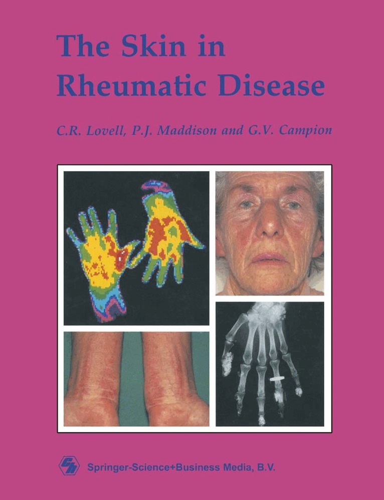 Skin in Rheumatic Disease