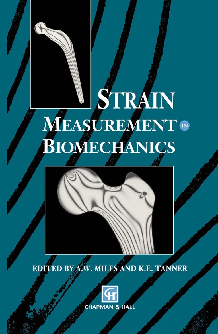 A.W. Miles, K.E. Tanner - Strain Measurement in Biomechanics, Inbunden