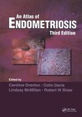 Atlas of Endometriosis