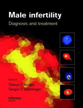 Sergio Oehninger, Thinus Kruger - Male Infertility, Inbunden. Tillgänglighet: Tillfälligt slut