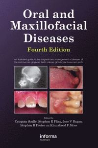 Oral and Maxillofacial Diseases, Fourth Edition