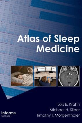 Lois E. Krahn, Michael H. Silber, Timothy I. Morgenthaler - Atlas of Sleep Medicine, Inbunden. Tillgänglighet: Tillfälligt slut