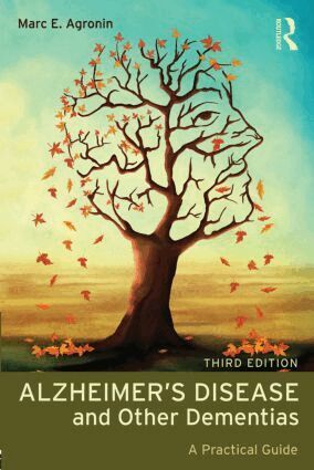 Marc E. Agronin - Alzheimer's Disease and Other Dementias, Häftad. Tillgänglighet: Lägg i varukorg