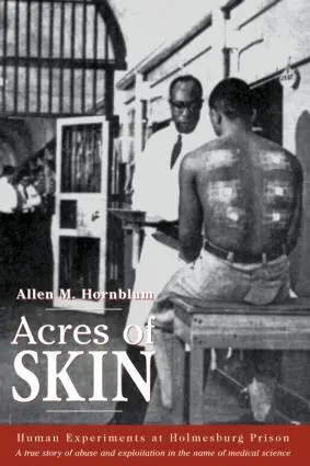 Allen M. Hornblum - Acres of Skin, Inbunden. Tillgänglighet: Lägg i varukorg