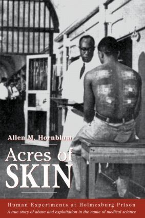 Allen M. Hornblum - Acres of Skin, Häftad. Tillgänglighet: Lägg i varukorg