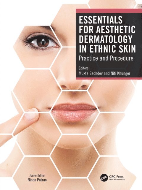 Niti Khunger, Mukta Sachdev - Essentials for Aesthetic Dermatology in Ethnic Skin, E-bok