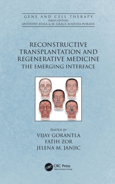 Jelena M. Janjic, Faith Zor, Vijay Gorantla - Reconstructive Transplantation and Regenerative Medicine, E-bok