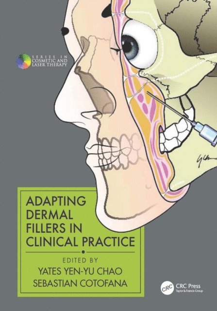 Sebastian Cotofana, Yates Yen-Yu Chao - Adapting Dermal Fillers in Clinical Practice, E-bok