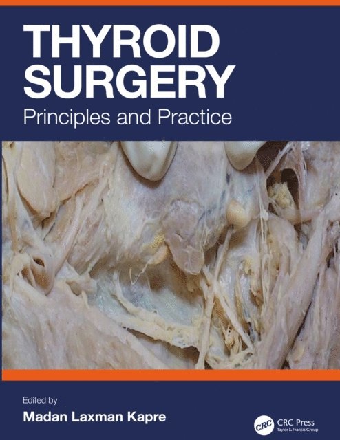 Madan Kapre - Thyroid Surgery, E-bok