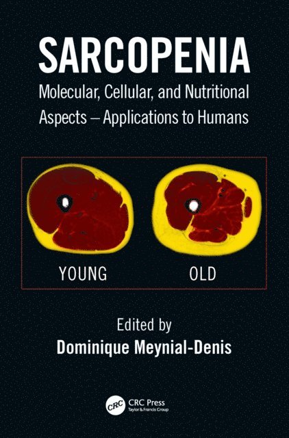 Dominique Meynial-Denis - Sarcopenia, E-bok