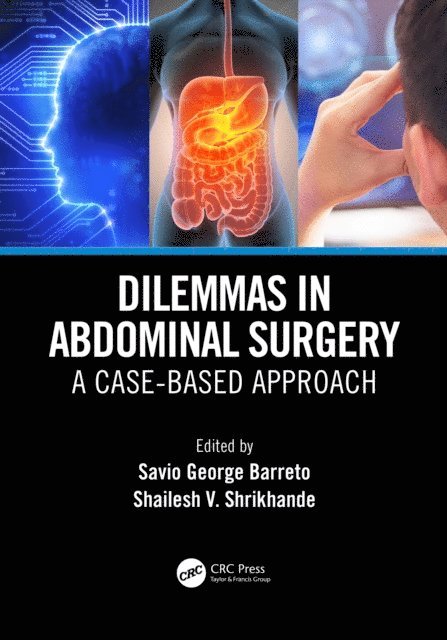 Shailesh Vinayak Shrikhande, Savio George Alberto da Piedade Barreto - Dilemmas in Abdominal Surgery, E-bok