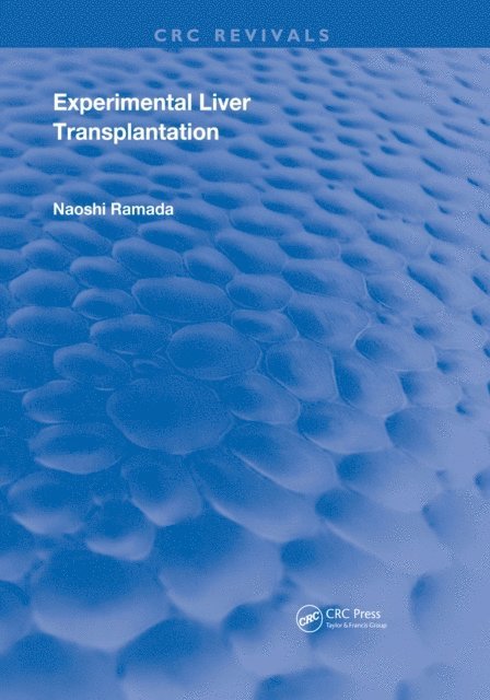 Naoshi Kamada - Experimental Liver Transplantation, E-bok. Tillgänglighet: Lägg i varukorg