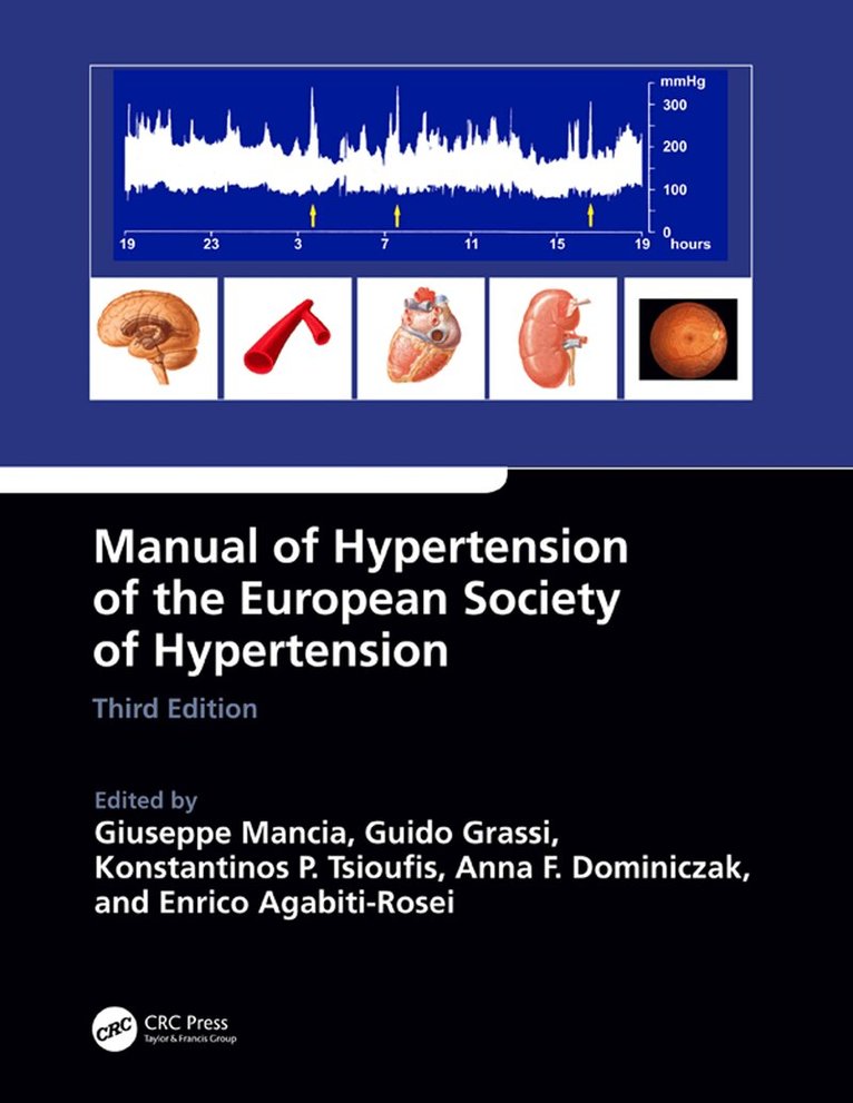 Giuseppe Mancia, Guido Grassi, Konstantinos P. Tsioufis, Anna F. Dominiczak, Enrico Agabiti Rosei - Manual of Hypertension of the European Society of Hypertension, Third Edition, E-bok