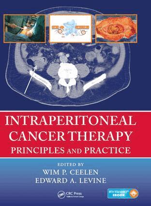 Wim P. Ceelen, Edward Levine - Intraperitoneal Cancer Therapy, E-bok