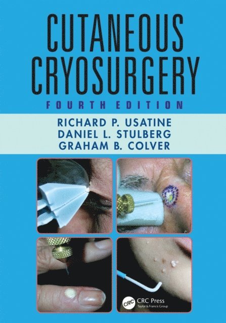 Graham B. Colver - Cutaneous Cryosurgery, E-bok