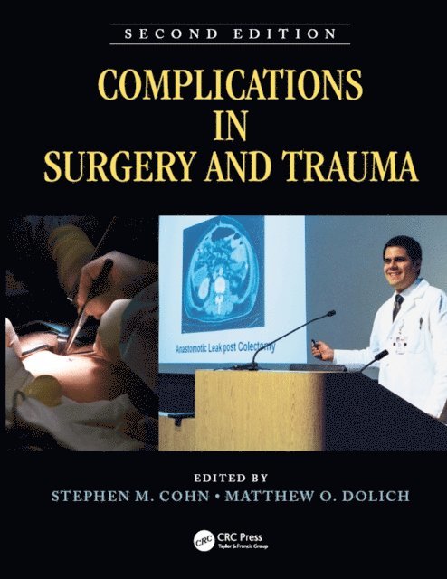 Matthew Dolich, Stephen Cohn - Complications in Surgery and Trauma, E-bok