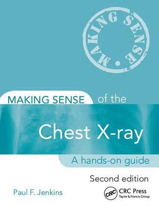 Paul Jenkins - Making Sense of the Chest X-ray, E-bok