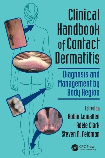 Steven R. Feldman, Adele Clark, Robin Lewallen - Clinical Handbook of Contact Dermatitis, E-bok
