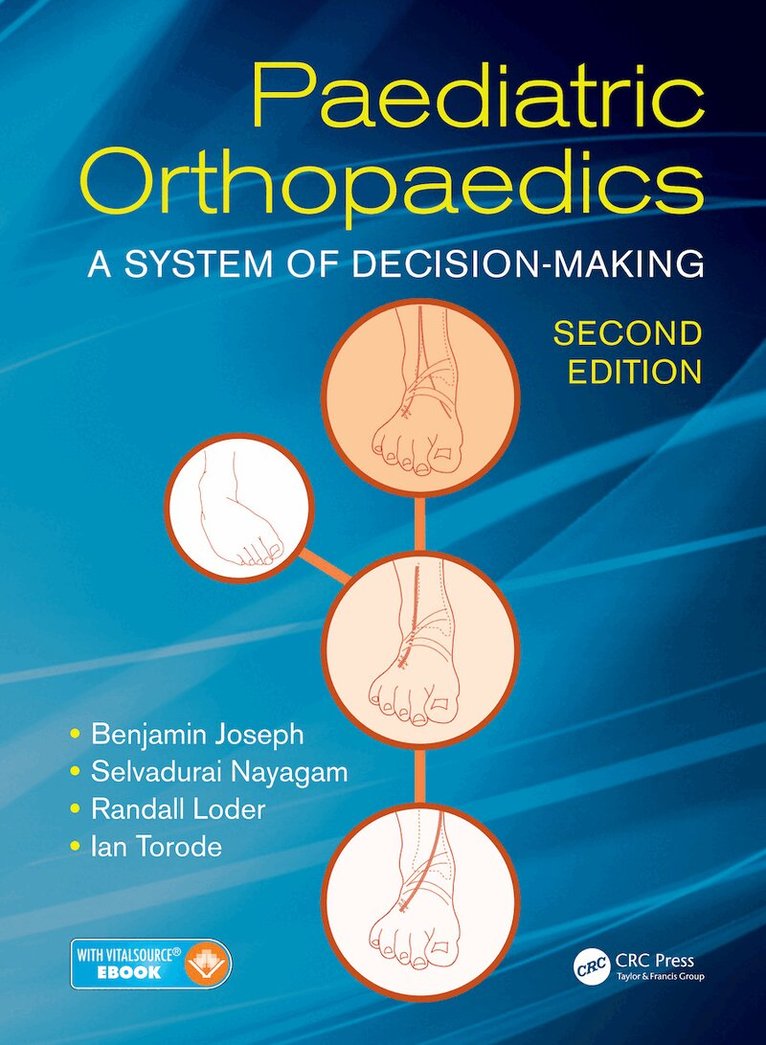 Benjamin Joseph, Selvadurai Nayagam, Randall Loder, Ian Torode - Paediatric Orthopaedics, E-bok
