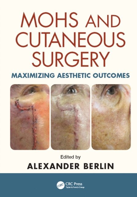 Alexander Berlin - Mohs and Cutaneous Surgery, E-bok