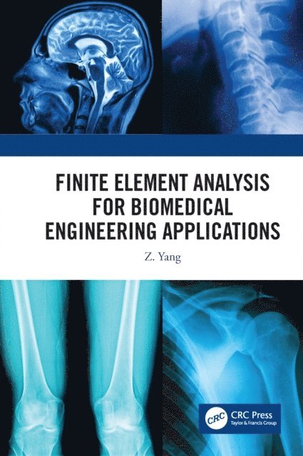 Z. Yang - Finite Element Analysis for Biomedical Engineering Applications, E-bok. Tillgänglighet: Lägg i varukorg