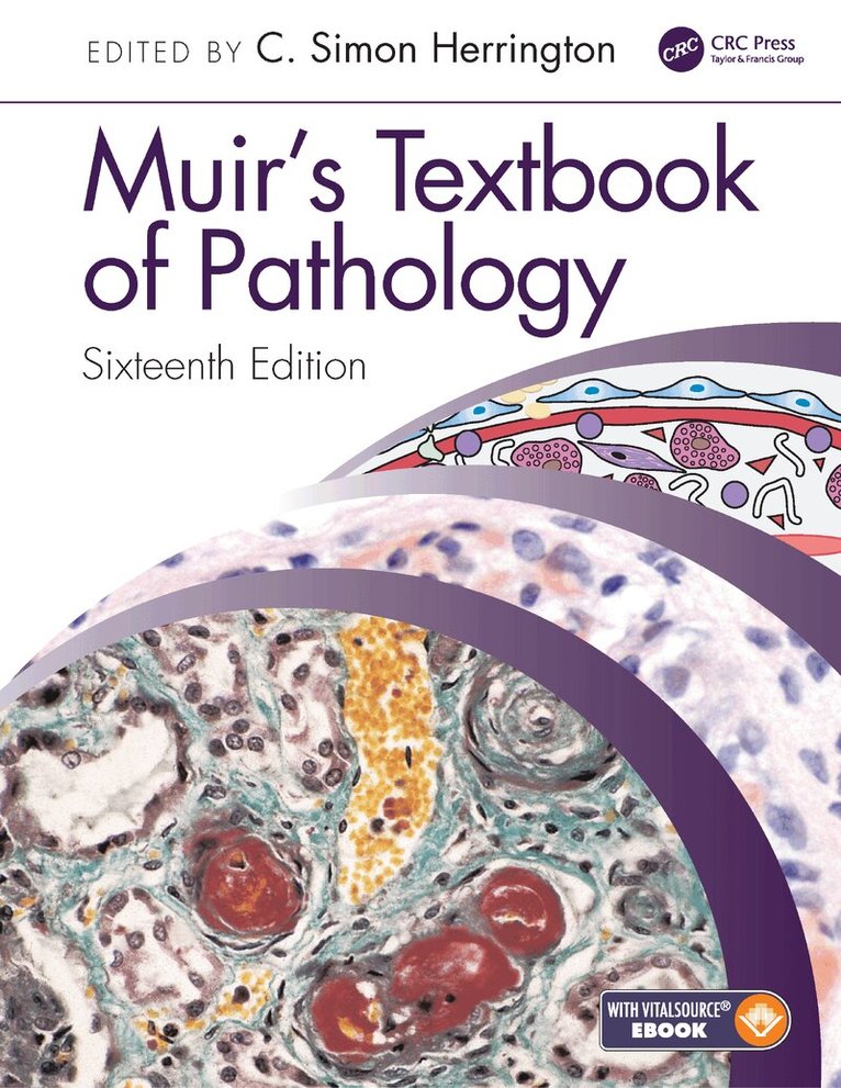 C Simon Herrington - Muir's Textbook of Pathology, E-bok