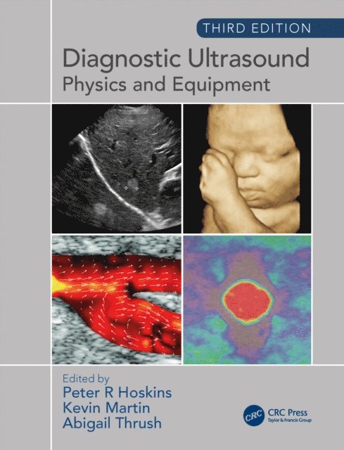 Abigail Thrush, Kevin Martin, Peter Hoskins - Diagnostic Ultrasound, Third Edition, E-bok
