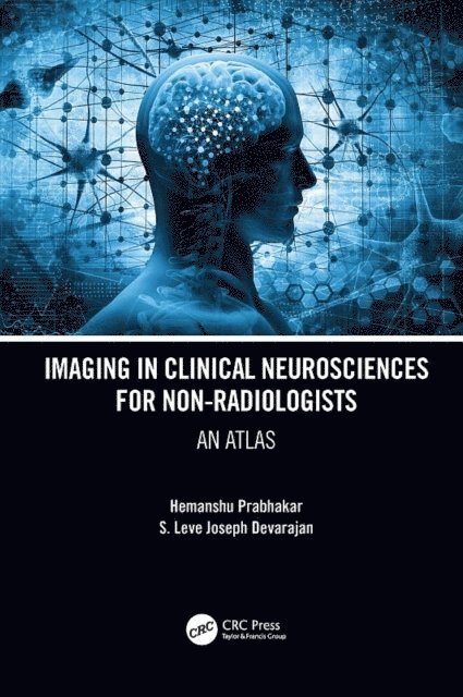 S. Leve Joseph Devarajan, Hemanshu Prabhakar - Imaging in Clinical Neurosciences for Non-radiologists, E-bok