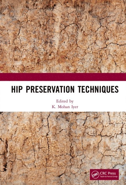K. Mohan Iyer - Hip Preservation Techniques, E-bok
