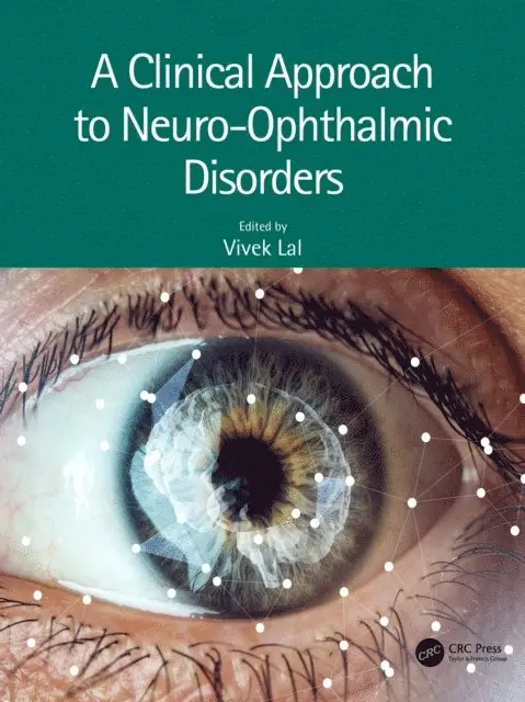 Clinical Approach to Neuro-Ophthalmic Disorders